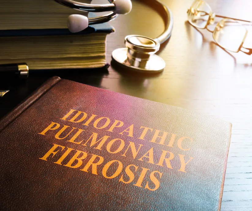 fibrosis pulmonar