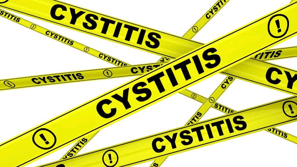 cistitis