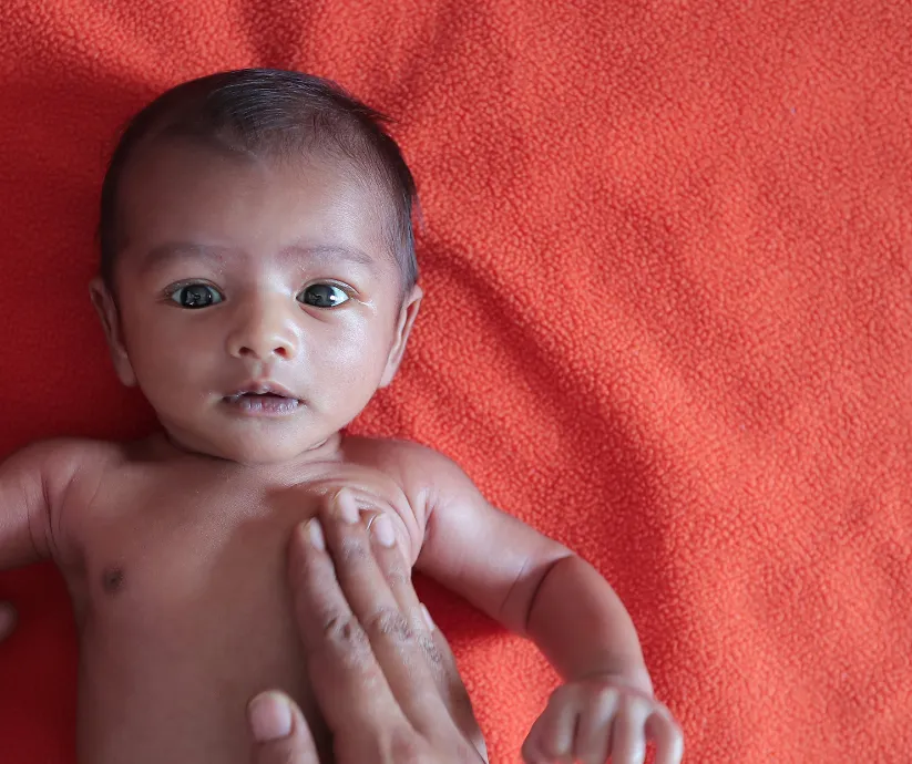 malnutricion infantil