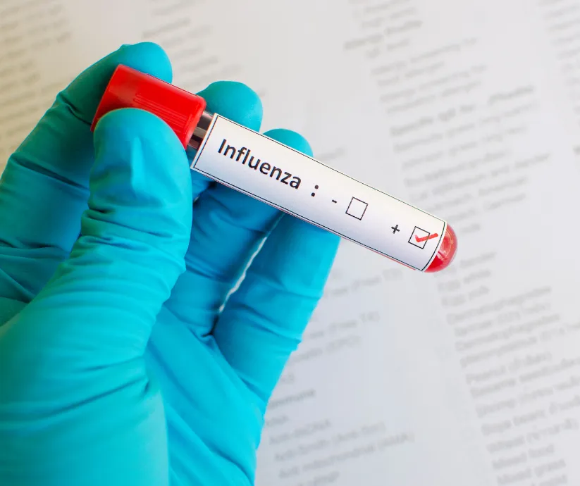 influenza 4