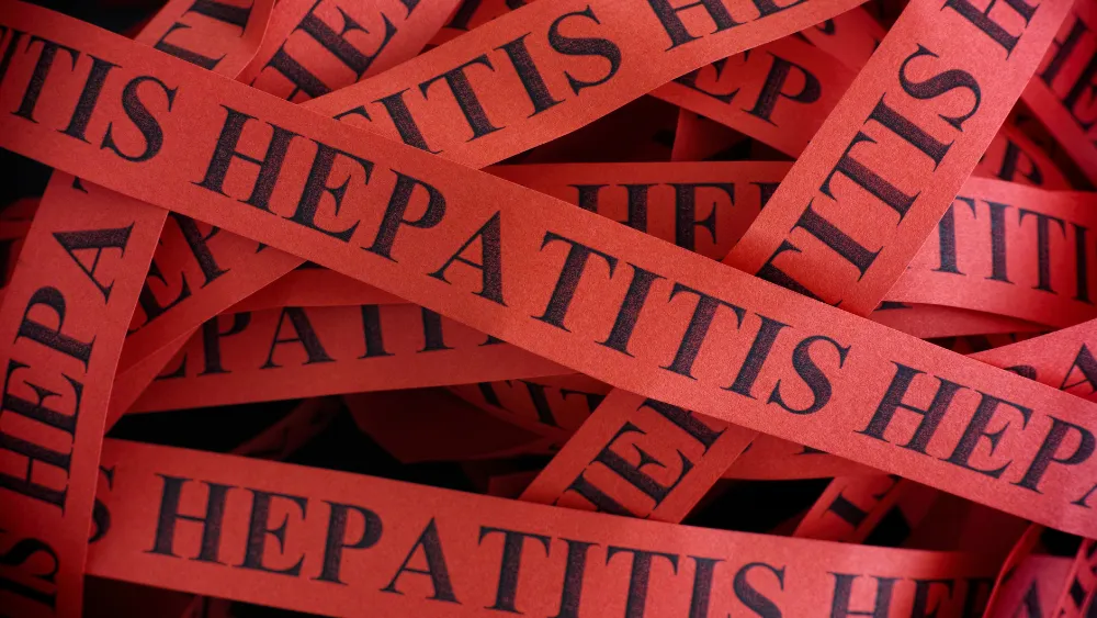 hepatitis toxica