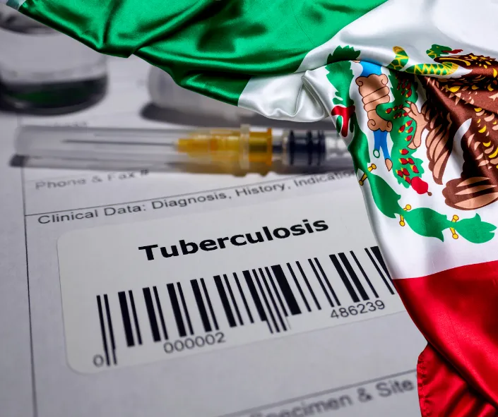 tuberculosis mexico