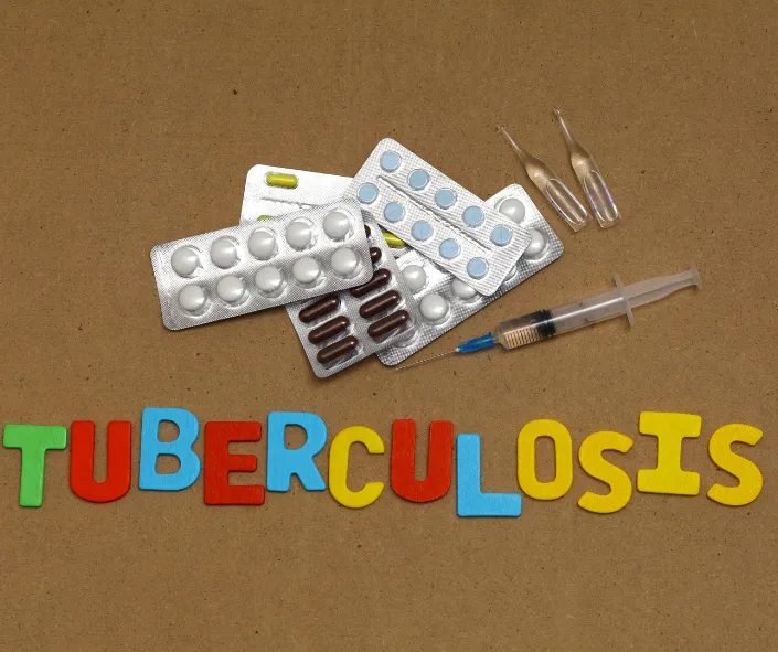 tuberculosis 4