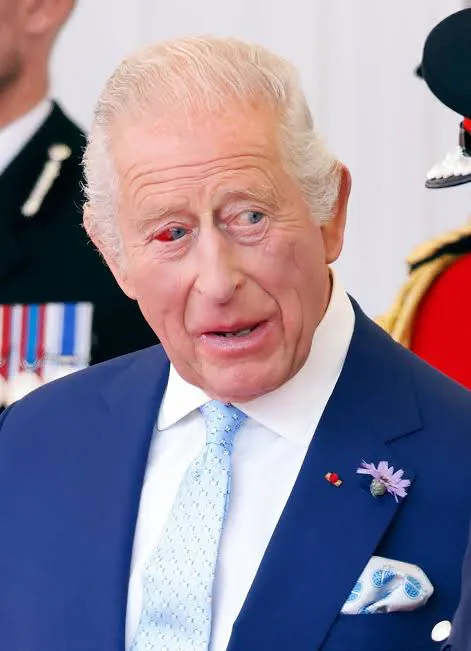 Salud del Rey Carlos III