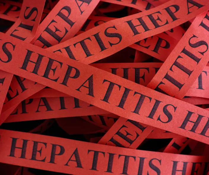 hepatitis